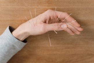 acupuncture sur la main